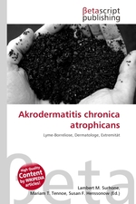 Akrodermatitis chronica atrophicans