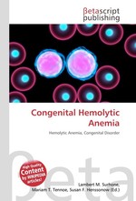 Congenital Hemolytic Anemia