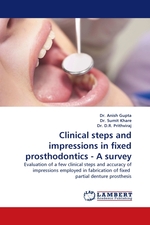 Clinical steps and impressions in fixed prosthodontics - A survey. Evaluation of a few clinical steps and accuracy of impressions employed in fabrication of fixed partial denture prosthesis