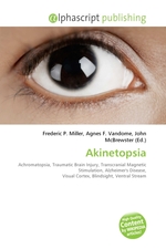 Akinetopsia