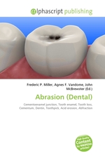 Abrasion (Dental)