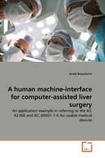 A human machine-interface for computer-assisted liver surgery. An application example in referring to the IEC 62366 and IEC 60601-1-6 for usable medical devices