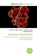 Coronary Thrombosis