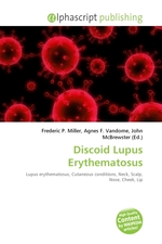 Discoid Lupus Erythematosus