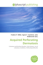Acquired Perforating Dermatosis