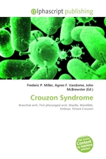 Crouzon Syndrome