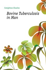 Bovine Tuberculosis in Man