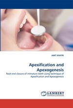 Apexification and Apexogenesis. Root end closure of immature teeth using technique of Apexification and Apexogenesis
