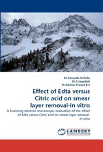 Effect of Edta versus Citric acid on smear layer removal-In vitro. A Scanning electron microscopic evaluation of the effect of Edta versus Citric acid on smear layer removal. In vitro
