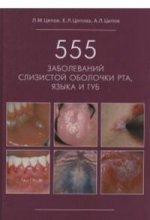 555заболеваний слизистой оболочки рта, языка и губ