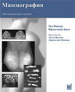 Маммография. 100 клинических случаев