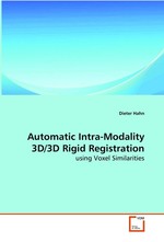 Automatic Intra-Modality 3D/3D Rigid Registration. using Voxel Similarities