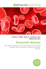 Kawasaki disease книга.