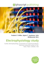 Electrophysiology study