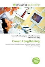 Crown Lengthening