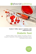 Diabetic foot