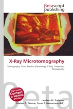 X-Ray Microtomography