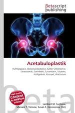 Acetabuloplastik