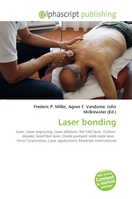 Laser bonding