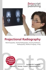 Projectional Radiography