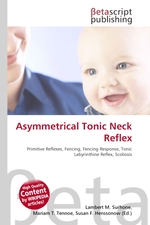 Asymmetrical Tonic Neck Reflex