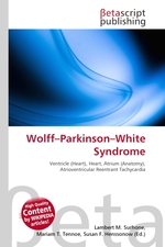 Wolff–Parkinson–White Syndrome