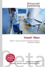 Voxel- Man