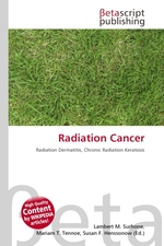 Radiation Cancer