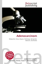 Adenocarcinom