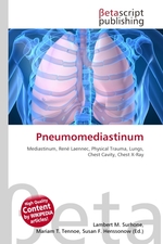 Pneumomediastinum