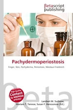 Pachydermoperiostosis