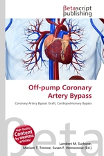 Off-pump Coronary Artery Bypass