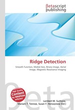 Ridge Detection