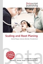 Scaling and Root Planing