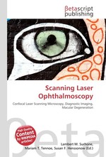 Scanning Laser Ophthalmoscopy