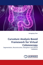 Curvature Analysis Based Framework for Virtual Colonoscopy. Segmentation, Reconstruction, Navigation and Clinical Validation