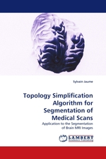 Topology Simplification Algorithm for Segmentation of Medical Scans. Application to the Segmentation of Brain MRI Images