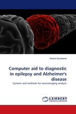 Computer aid to diagnostic in ?epilepsy and ?Alzheimers disease. Systems and methods for neuroimaging analysis