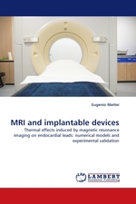 MRI and implantable devices. Thermal effects induced by magnetic resonance imaging on endocardial leads: numerical models and experimental validation