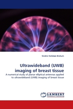 Ultrawideband (UWB) imaging of breast tissue. A numerical study of planar elliptical antennas applied to ultrawideband (UWB) imaging of breast tissue