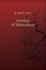 Aetiology of Tuberculosis