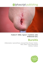 Bursitis