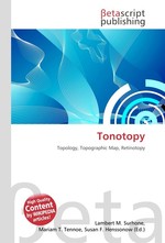 Tonotopy