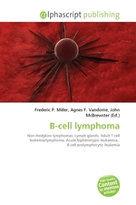 B-cell lymphoma