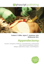 Appendectomy