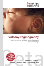 Videonystagmography