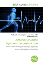 Anterior cruciate ligament reconstruction