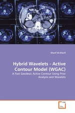 Hybrid Wavelets - Active Contour Model (WGAC). A Fast Geodesic Active Contour Using Prior Analysis and Wavelets