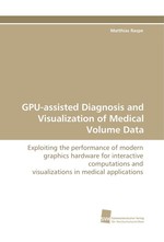 GPU-assisted Diagnosis and Visualization of Medical Volume Data. Exploiting the performance of modern graphics hardware for interactive computations and visualizations in medical applications
