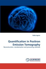 Quantification in Positron Emission Tomography. Reconstruction, standarization and processing methods